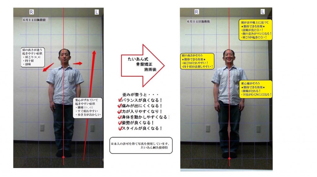 たいあん式骨盤矯正を行ったお客様の施術前と施術後の写真をくらべてみました