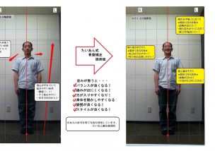 たいあん式骨盤矯正を行ったお客様の施術前と施術後の写真をくらべてみました